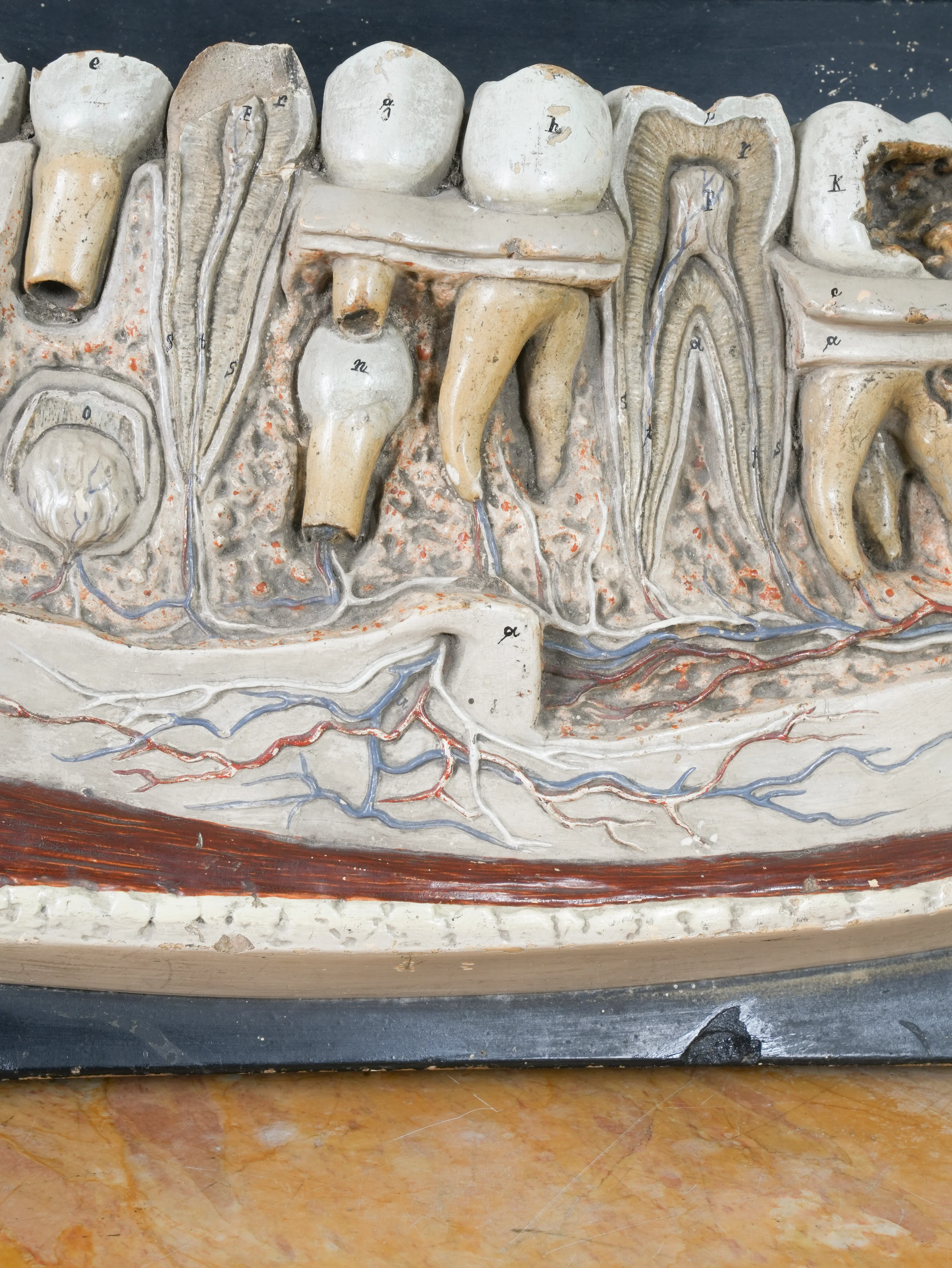 A 19th Century Plaster Didactic Model of Malformed Teeth - Image 10