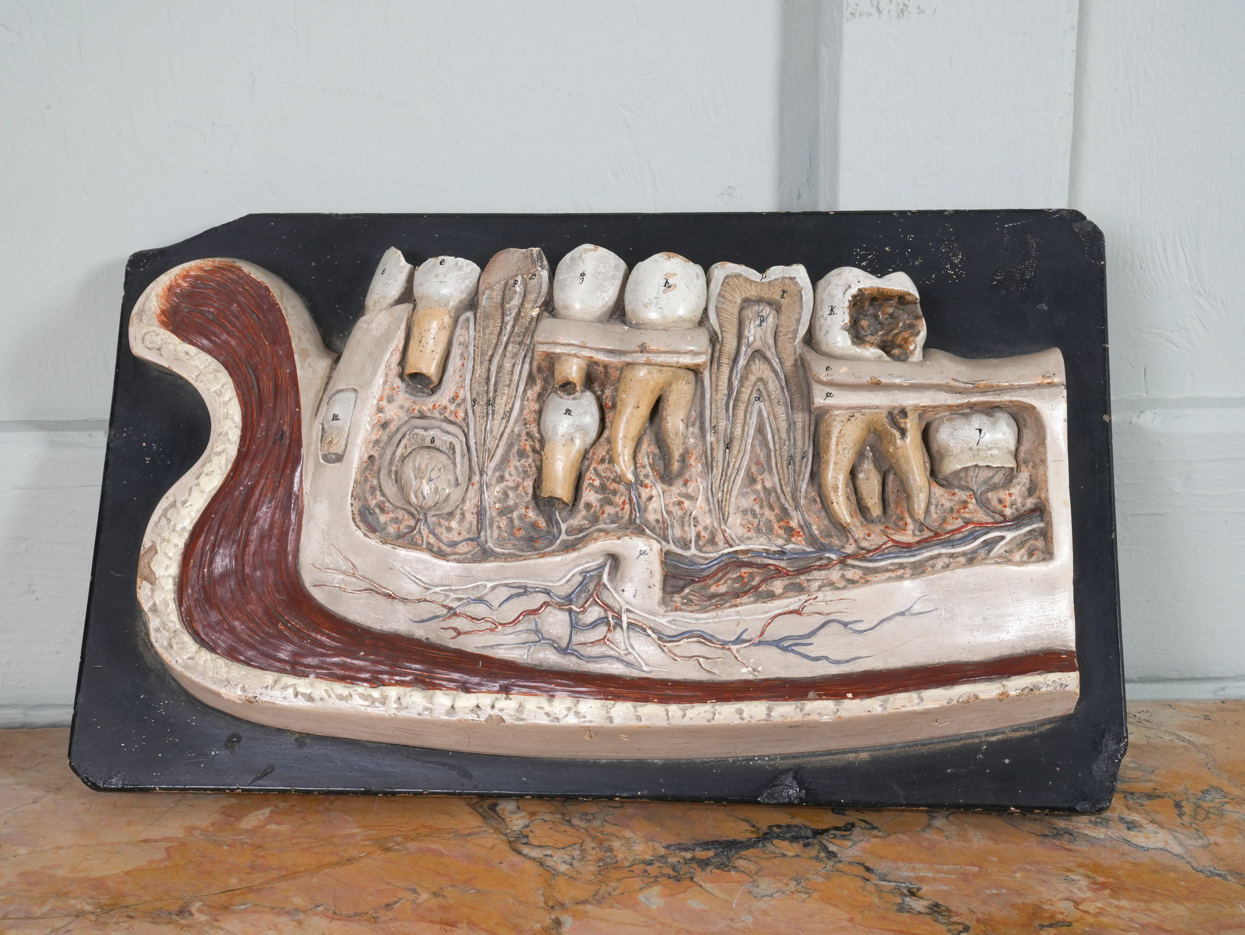 A 19th Century Plaster Didactic Model of Malformed Teeth - Image 4